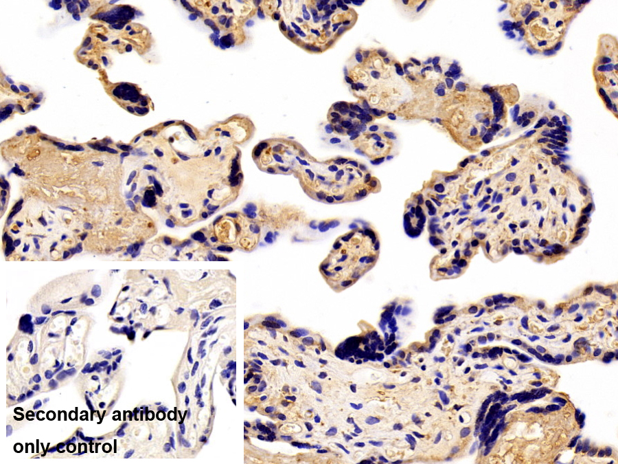 Polyclonal Antibody to Furin (FUR)