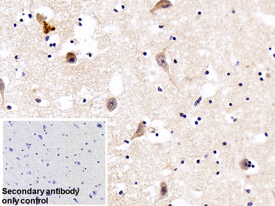 Polyclonal Antibody to Furin (FUR)