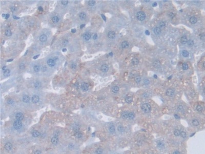 Polyclonal Antibody to Guanidinoacetate-N-Methyltransferase (GAMT)