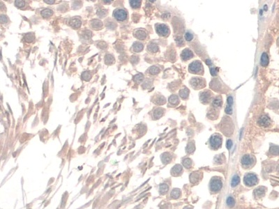 Polyclonal Antibody to Guanidinoacetate-N-Methyltransferase (GAMT)