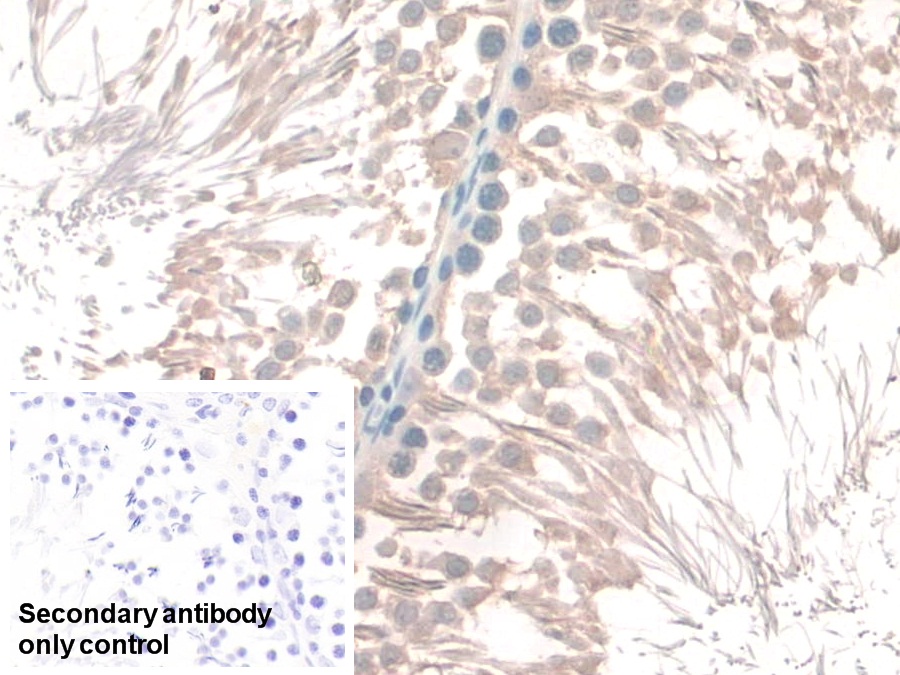 Polyclonal Antibody to Guanidinoacetate-N-Methyltransferase (GAMT)