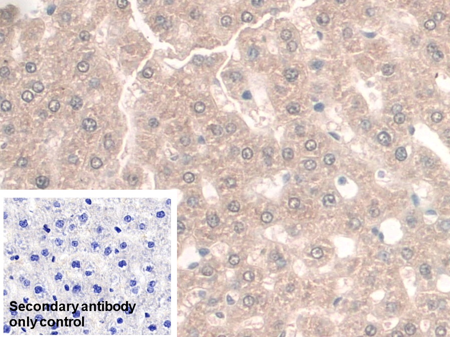 Polyclonal Antibody to Guanidinoacetate-N-Methyltransferase (GAMT)