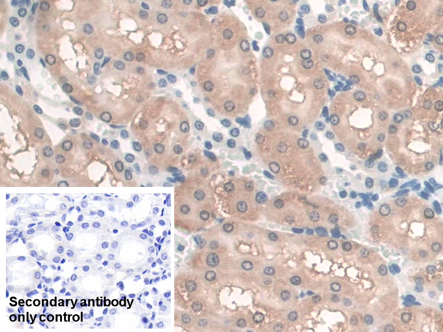 Polyclonal Antibody to Guanidinoacetate-N-Methyltransferase (GAMT)