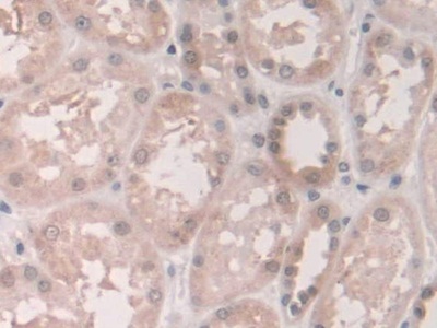 Polyclonal Antibody to Grancalcin (GCA)