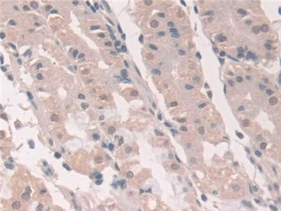 Polyclonal Antibody to Grancalcin (GCA)