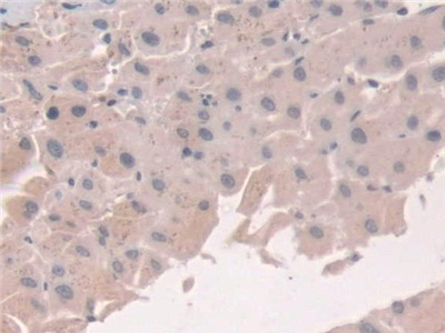 Polyclonal Antibody to Grancalcin (GCA)