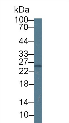 Polyclonal Antibody to Grancalcin (GCA)