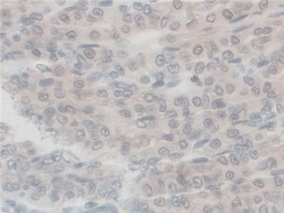 Polyclonal Antibody to G-Elongation Factor, Mitochondrial 1 (GFM1)