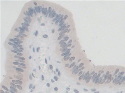 Polyclonal Antibody to G-Elongation Factor, Mitochondrial 1 (GFM1)