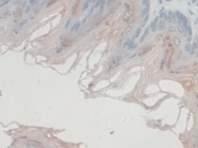 Polyclonal Antibody to G-Elongation Factor, Mitochondrial 1 (GFM1)