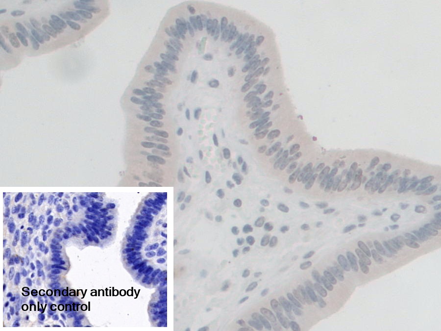 Polyclonal Antibody to G-Elongation Factor, Mitochondrial 1 (GFM1)