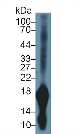 Polyclonal Antibody to Gastrokine 1 (GKN1)