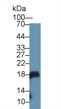 Polyclonal Antibody to Gastrokine 1 (GKN1)