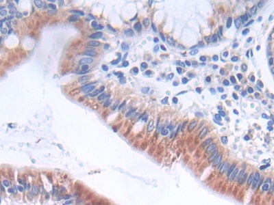 Polyclonal Antibody to Glycolipid Transfer Protein (GLTP)