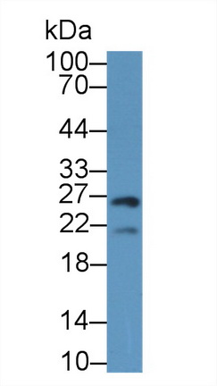 Polyclonal Antibody to Geminin (GMNN)