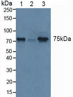 Polyclonal Antibody to Glucocerebrosidase (GBA)