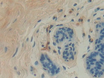 Polyclonal Antibody to Glucocerebrosidase (GBA)