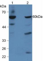 Polyclonal Antibody to Glucocerebrosidase (GBA)