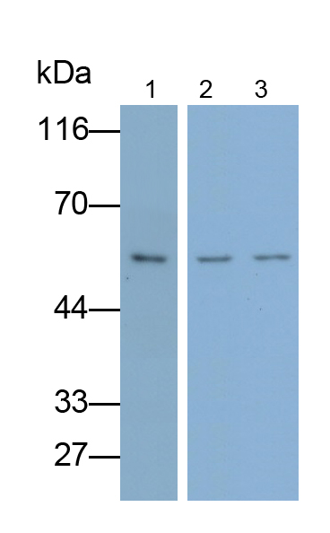 Polyclonal Antibody to Glucocerebrosidase (GBA)