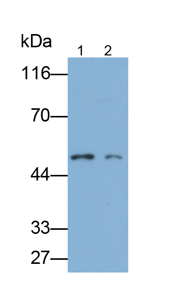 Polyclonal Antibody to Glucocerebrosidase (GBA)