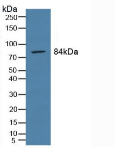 Polyclonal Antibody to Prostate-specific Membrane Antigen (PMSA)