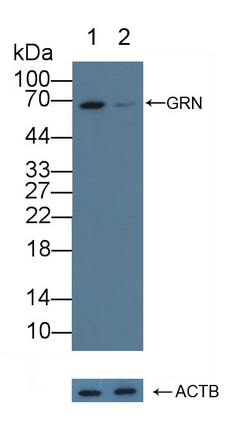 Polyclonal Antibody to Granulin (GRN)