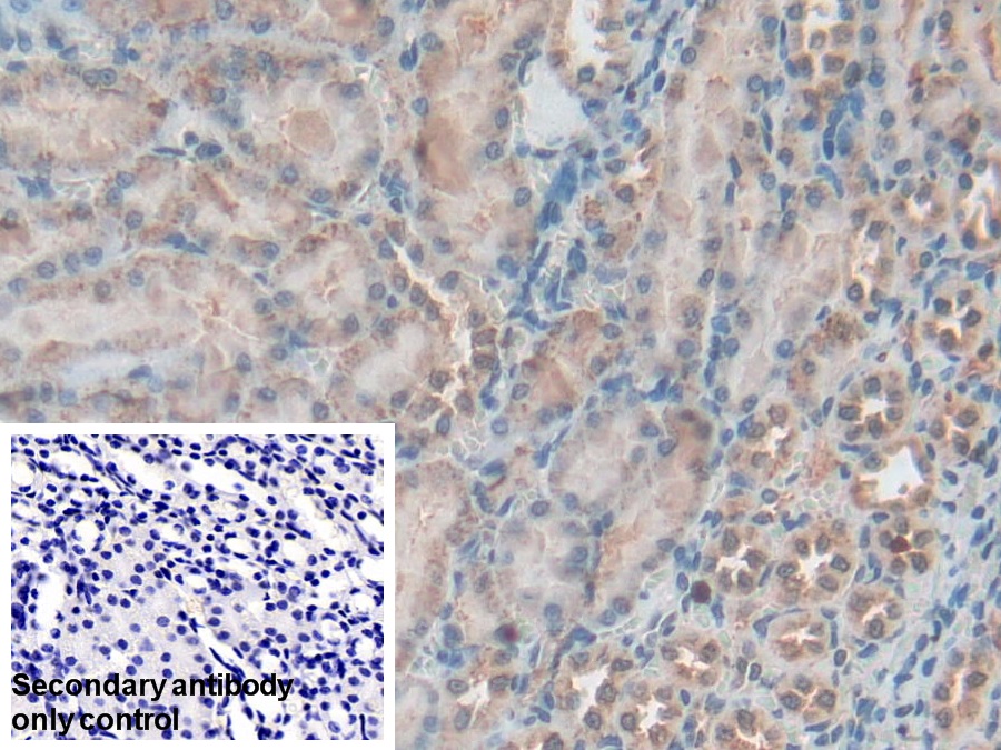 Polyclonal Antibody to Granulin (GRN)