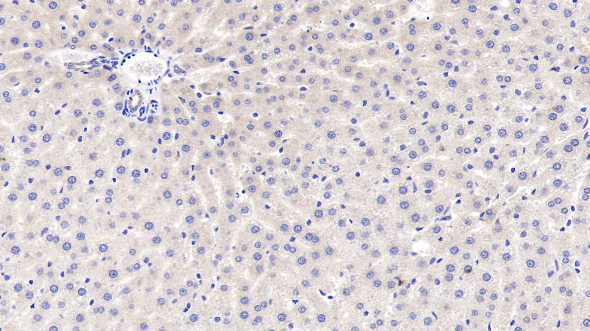 Polyclonal Antibody to Granulin (GRN)