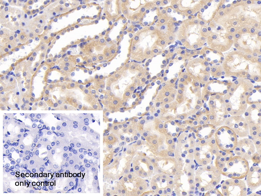 Polyclonal Antibody to Granulin (GRN)