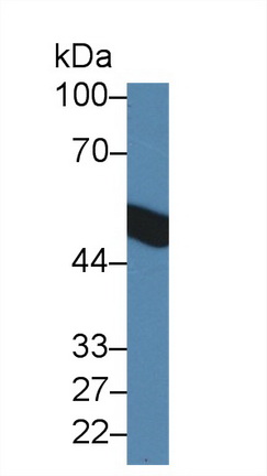 Polyclonal Antibody to Hyaluronan Binding Protein 2 (HABP2)