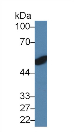 Polyclonal Antibody to Hyaluronan Binding Protein 2 (HABP2)