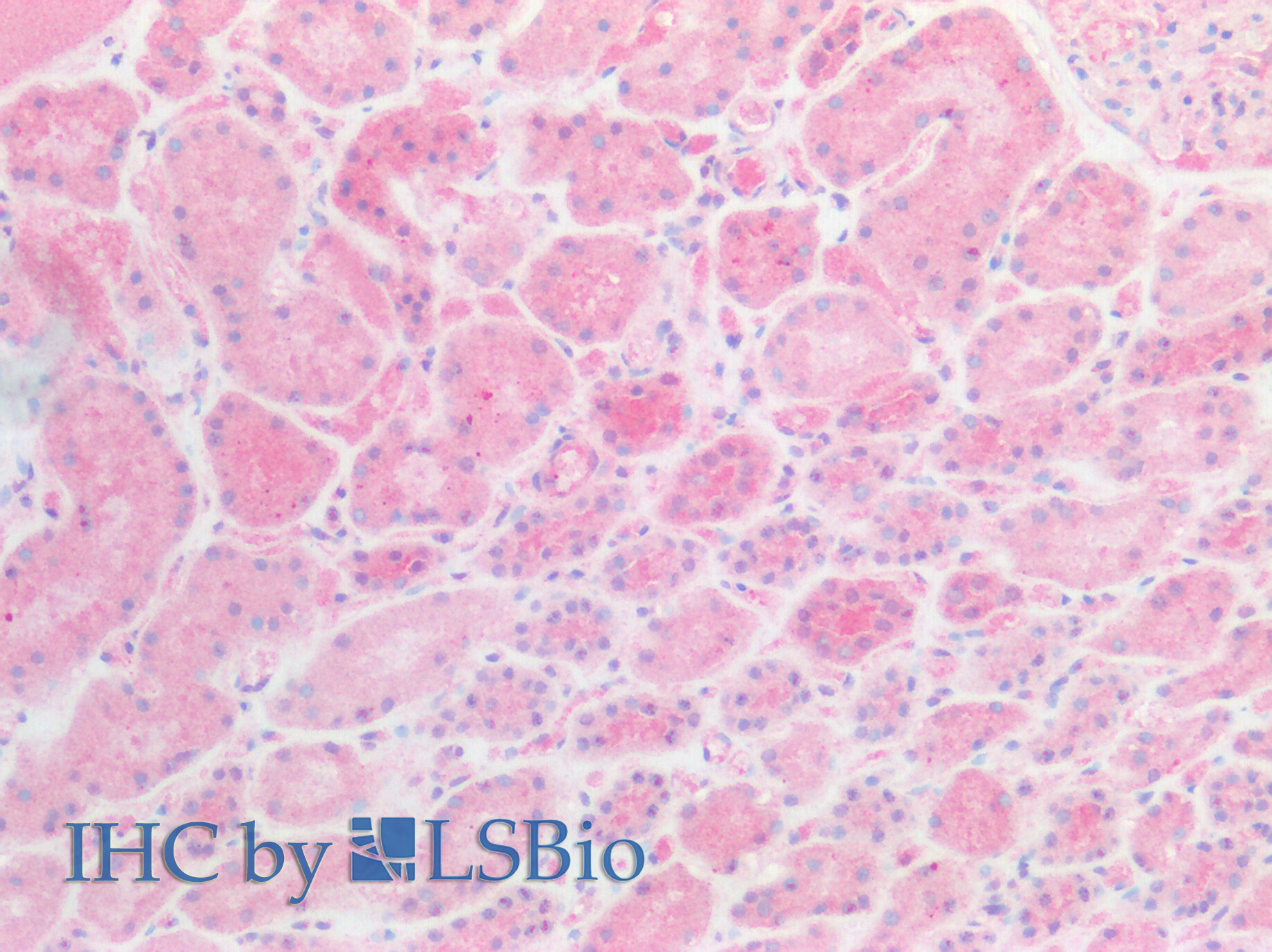 Polyclonal Antibody to Hyaluronan Binding Protein 2 (HABP2)