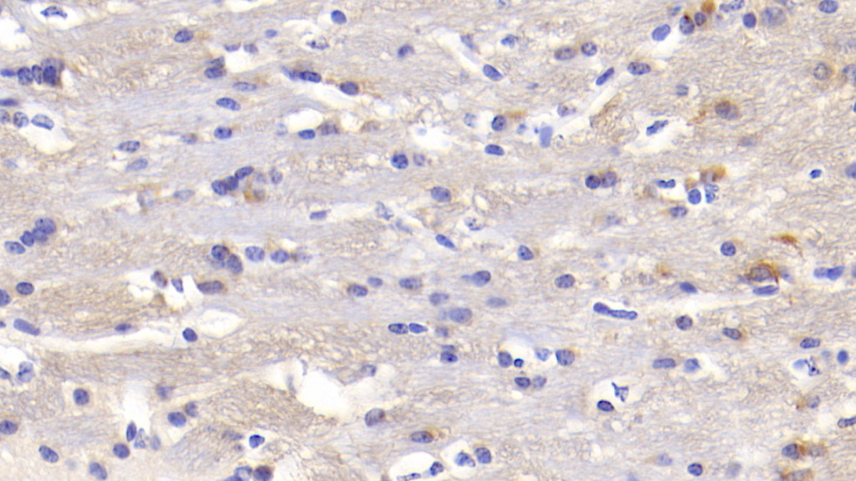 Polyclonal Antibody to Heart And Neural Crest Derivatives Expressed Protein 1 (HAND1)