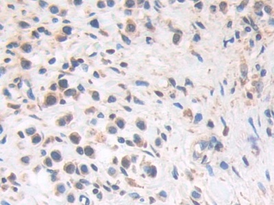 Polyclonal Antibody to Helicase Like Transcription Factor (HLTF)