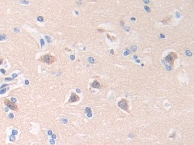 Polyclonal Antibody to Helicase Like Transcription Factor (HLTF)