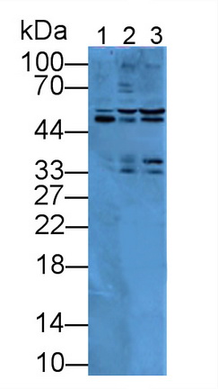 Polyclonal Antibody to Islet Cell Autoantigen 1 (ICA1)