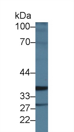 Polyclonal Antibody to Intestinal Cell Kinase (ICK)