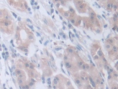 Polyclonal Antibody to Nephronophthisis 2, Infantile (NPHP2)