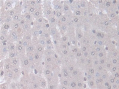 Polyclonal Antibody to Intersectin 1 (ITSN1)