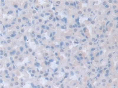 Polyclonal Antibody to Intersectin 1 (ITSN1)