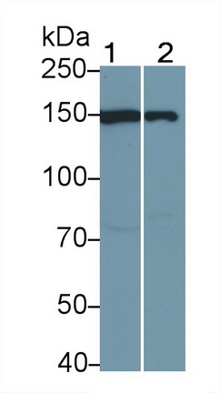 Polyclonal Antibody to Janus Kinase 1 (JAK1)