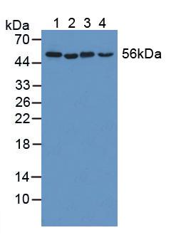 Polyclonal Antibody to Katanin P60 Subunit A 1 (KATNA1)