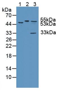 Polyclonal Antibody to Katanin P60 Subunit A 1 (KATNA1)