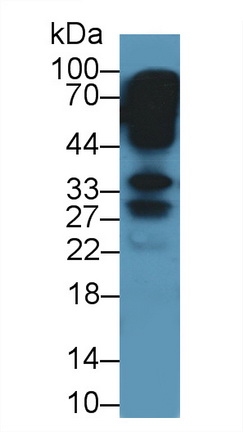 Polyclonal Antibody to Keratocan (KERA)