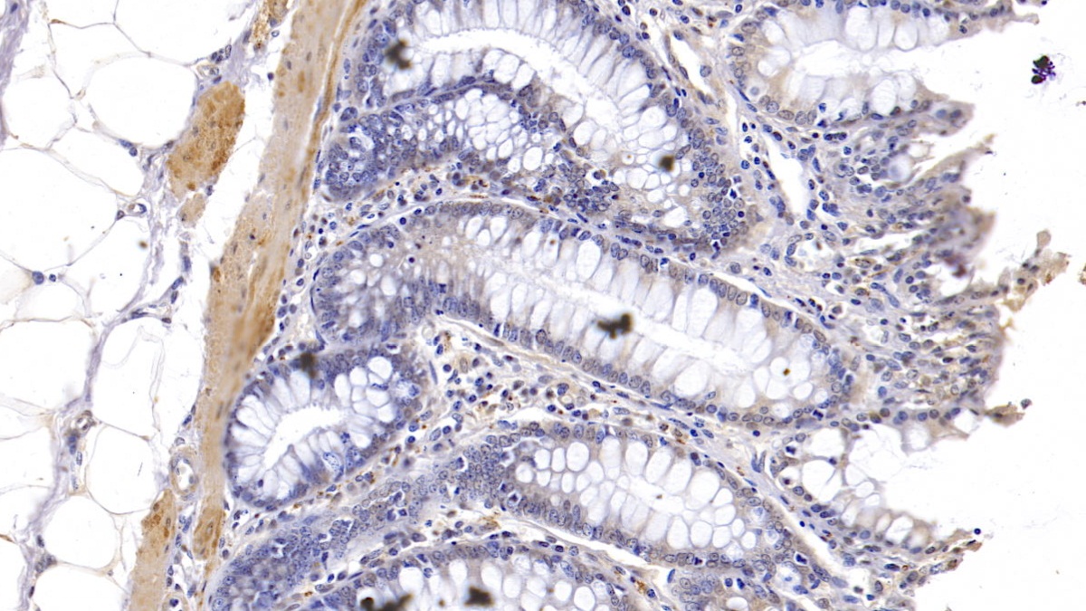 Polyclonal Antibody to Karyopherin Alpha 3 (KPNa3)