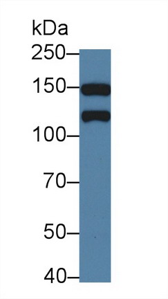 Polyclonal Antibody to Kinectin 1 (KTN1)