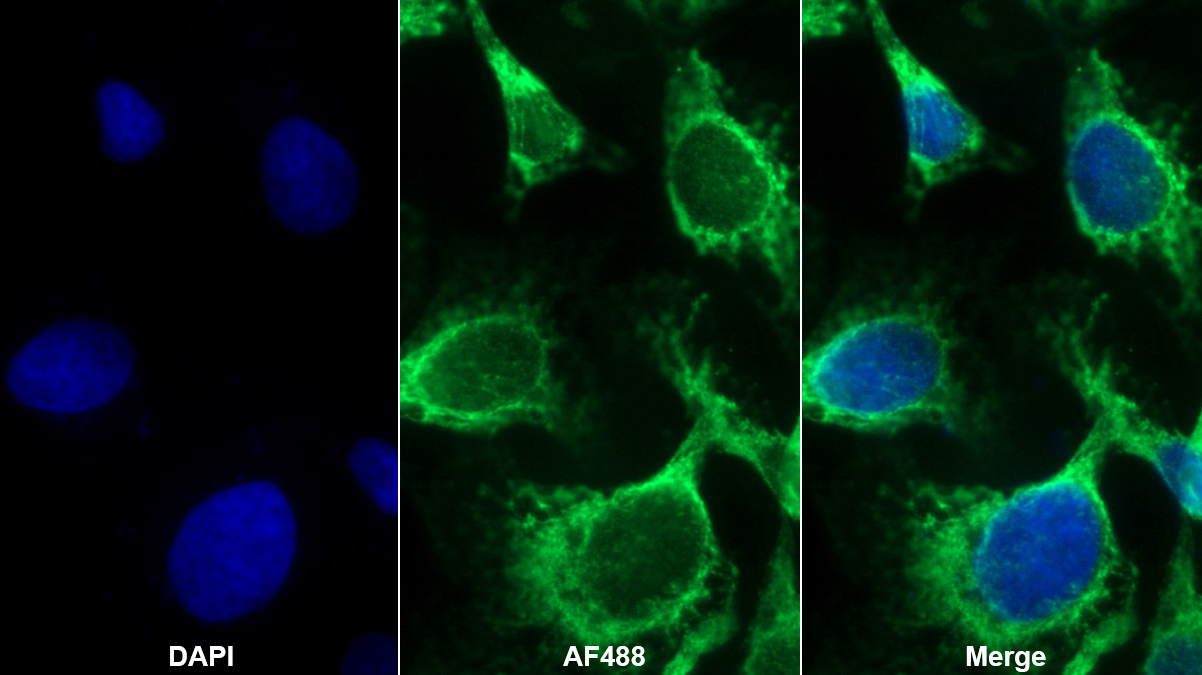 Polyclonal Antibody to Kinectin 1 (KTN1)