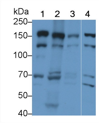 Polyclonal Antibody to Kinectin 1 (KTN1)