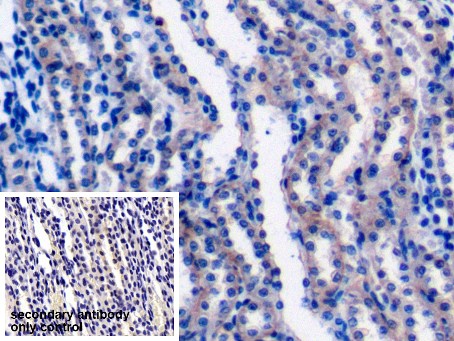 Polyclonal Antibody to Ladinin 1 (LAD1)