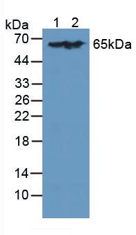 Polyclonal Antibody to L-Plastin (LCP1)